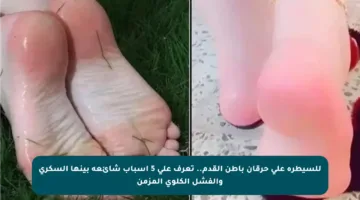 للسيطرة على حرقان باطن القدم.. تعرف على 5 أسباب شائعة بينها السكري والفشل الكلوي المزمن